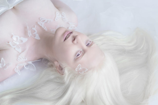 альбиносы модели